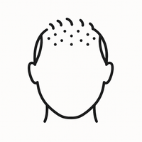 Chronic / Hereditary Hair Loss