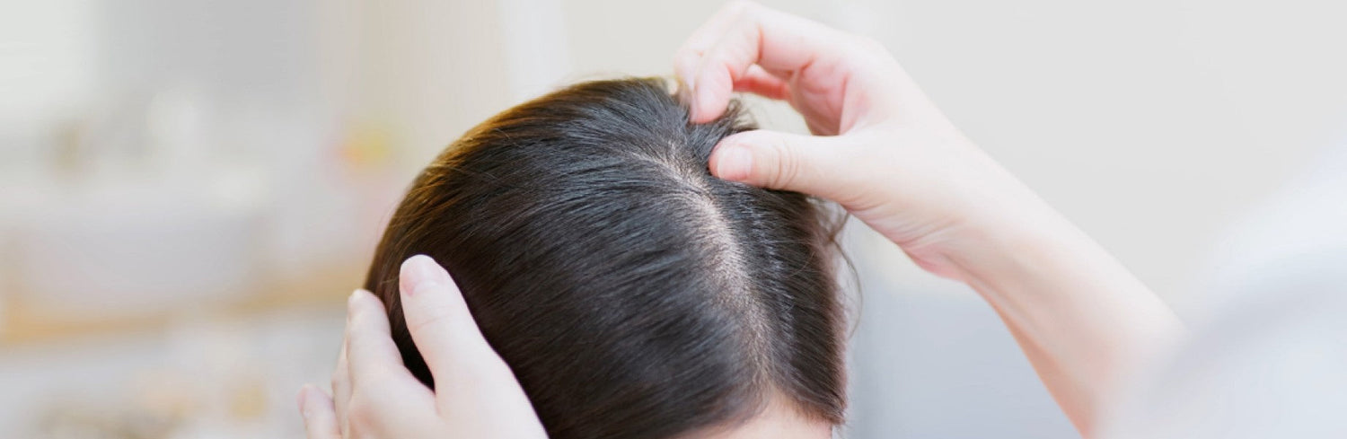 Female Hair Loss Treatment: Real Causes and Proven Solutions for Women