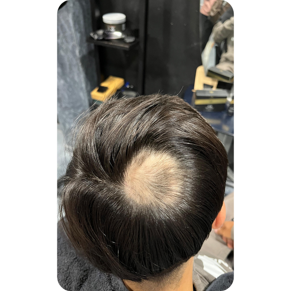 Before transformation
