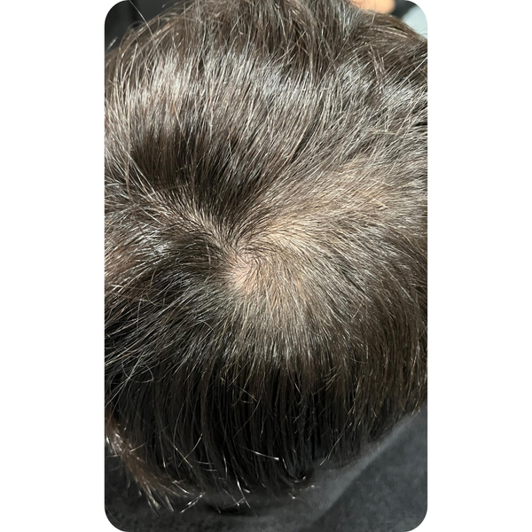 After transformation