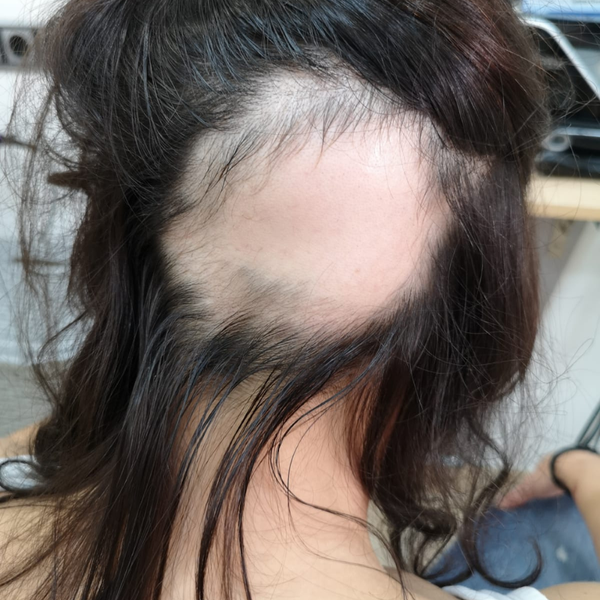 Before transformation